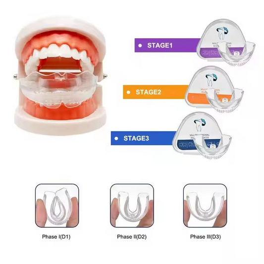 Kit d'alignement dentaire - 3 phases
